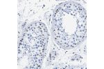 Immunohistochemical staining of human testis shows moderate nuclear positivity in a subset of cells in seminiferus ducts.