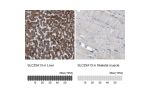 Immunohistochemistry analysis in human liver and skeletal muscle tissues using HPA018997 antibody. Corresponding SLC25A13 RNA-seq data are presented for the same tissues.