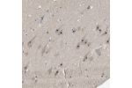 Immunohistochemical staining of human hippocampus shows strong nucleolar positivity in neuronal cells.