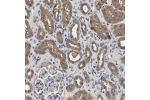 Immunohistochemical staining of human kidney shows moderate cytoplasmic positivity in cells in tubules.