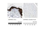 Immunohistochemistry analysis in human skin and skeletal muscle tissues using HPA019025 antibody. Corresponding SERPINB5 RNA-seq data are presented for the same tissues.