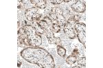 Immunohistochemical staining of human placenta shows moderate nuclear positivity in trophoblastic cells.