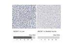 Immunohistochemistry analysis in human liver and skeletal muscle tissues using HPA019035 antibody. Corresponding ABCB11 RNA-seq data are presented for the same tissues.