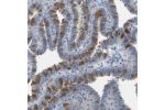 Immunohistochemical staining of human fallopian tube shows strong positivity in a subset of glandular cells.