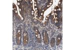 Immunohistochemical staining of human small intestine shows strong cytoplasmic positivity in glandular cells.