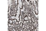 Immunohistochemical staining of human duodenum shows strong nuclear positivity in glandular cells.