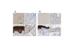 Immunohistochemical staining of human cerebral cortex, liver, skin and testis using Anti-SERPINB5 antibody HPA019132 (A) shows similar protein distribution across tissues to independent antibody HPA019025 (B).