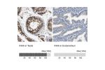 Immunohistochemistry analysis in human testis and endometrium tissues using Anti-INHA antibody. Corresponding INHA RNA-seq data are presented for the same tissues.