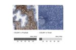 Immunohistochemistry analysis in human prostate and pancreas tissues using HPA019142 antibody. Corresponding COL6A1 RNA-seq data are presented for the same tissues.