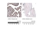 Immunohistochemistry analysis in human fallopian tube and skeletal muscle tissues using HPA019149 antibody. Corresponding JUNB RNA-seq data are presented for the same tissues.