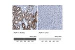 Immunohistochemistry analysis in human kidney and liver tissues using HPA019206 antibody. Corresponding AQP1 RNA-seq data are presented for the same tissues.