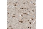 Immunohistochemical staining of human cerebral cortex shows strong cytoplasmic positivity in neuronal cells.