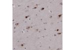 Immunohistochemical staining of human hippocampus shows strong nuclear positivity in neuronal cells.