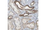 Immunohistochemical staining of human kidney shows strong membranous positivity in cells in tubules.