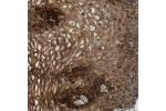 Immunohistochemical staining of human esophagus shows strong cytoplasmic positivity in squamous epithelial cells.