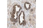 Immunohistochemical staining of human prostate shows strong cytoplasmic positivity in glandular cells.