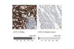 Immunohistochemistry analysis in human kidney and skeletal muscle tissues using HPA019371 antibody. Corresponding ACO1 RNA-seq data are presented for the same tissues.