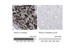 Immunohistochemistry analysis in human prostate and skeletal muscle tissues using HPA019467 antibody. Corresponding TAGLN RNA-seq data are presented for the same tissues.