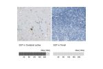 Immunohistochemistry analysis in human cerebral cortex and tonsil tissues using HPA019472 antibody. Corresponding SST RNA-seq data are presented for the same tissues.