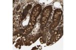 Immunohistochemical staining of human colon shows strong cytoplasmic positivity in glandular cells.