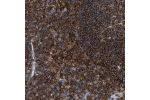 Immunohistochemical staining of human lymph node shows strong cytoplasmic positivity in non-germinal center cells.