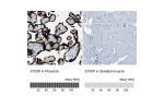 Immunohistochemistry analysis in human placenta and skeletal muscle tissues using Anti-S100P antibody. Corresponding S100P RNA-seq data are presented for the same tissues.