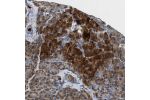 Immunohistochemical staining of human pancreas shows strong cytoplasmic positivity in exocrine glandular cells.