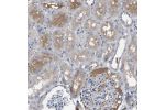 Immunohistochemical staining of human kidney shows moderate positivity in plasma.