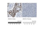 Immunohistochemistry analysis in human kidney and pancreas tissues using Anti-AMACR antibody. Corresponding AMACR RNA-seq data are presented for the same tissues.