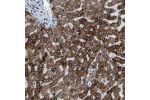 Immunohistochemical staining of human liver shows very strong granular cytoplasmic positivity in hepatocytes.