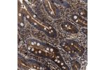 Immunohistochemical staining of human duodenum shows strong cytoplasmic positivity in glandular cells.