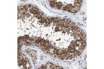 Immunohistochemical staining of human duodenum shows strong granular positivity in glandular cells.
