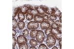 Immunohistochemical staining of human Stomach shows strong cytoplasmic and membranous positivity in glandular cells.