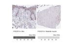Immunohistochemistry analysis in human skin and skeletal muscle tissues using HPA019652 antibody. Corresponding POU2F3 RNA-seq data are presented for the same tissues.