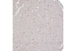 Immunohistochemical staining of human Cerebral cortex shows moderate cytoplasmic positivity in neuronal cells.