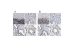 Immunohistochemical staining of human cerebellum, kidney, prostate and testis using Anti-TPR antibody HPA019661 (A) shows similar protein distribution across tissues to independent antibody HPA019663 (B).