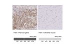 Immunohistochemistry analysis in human adrenal gland and skeletal muscle tissues using HPA019684 antibody. Corresponding NOV RNA-seq data are presented for the same tissues.