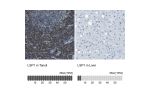 Immunohistochemistry analysis in human spleen and cerebral cortex tissues using Anti-LSP1 antibody. Corresponding LSP1 RNA-seq data are presented for the same tissues.