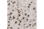 Immunohistochemical staining of human cerebral cortex shows strong nuclear positivity in neuronal cells.