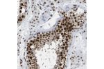 Immunohistochemical staining of human testis shows strong nuclear positivity in cells in seminiferous ducts.