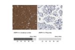 Immunohistochemistry analysis in human cerebral cortex and placenta tissues using HPA019828 antibody. Corresponding AMPH RNA-seq data are presented for the same tissues.