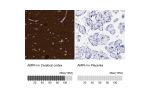 Immunohistochemistry analysis in human cerebral cortex and placenta tissues using HPA019829 antibody. Corresponding AMPH RNA-seq data are presented for the same tissues.