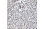 Immunohistochemical staining of human liver shows cytoplasmic positivity in hepatocytes.