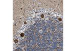 Immunohistochemical staining of human cerebellum shows strong granular cytoplasmic positivity in Purkinje cells.