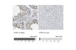 Immunohistochemistry analysis in human testis and liver tissues using HPA019887 antibody. Corresponding PCNT RNA-seq data are presented for the same tissues.