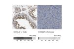 Immunohistochemistry analysis in human testis and pancreas tissues using Anti-SH3GLB1 antibody. Corresponding SH3GLB1 RNA-seq data are presented for the same tissues.