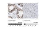 Immunohistochemistry analysis in human testis and liver tissues using HPA019907 antibody. Corresponding CCAR2 RNA-seq data are presented for the same tissues.