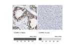 Immunohistochemistry analysis in human testis and liver tissues using HPA019943 antibody. Corresponding CCAR2 RNA-seq data are presented for the same tissues.