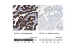 Immunohistochemistry analysis in human fallopian tube and skeletal muscle tissues using Anti-RUVBL1 antibody. Corresponding RUVBL1 RNA-seq data are presented for the same tissues.