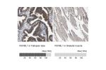 Immunohistochemistry analysis in human fallopian tube and skeletal muscle tissues using Anti-RUVBL1 antibody. Corresponding RUVBL1 RNA-seq data are presented for the same tissues.